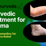 Ayurvedic Treatment for Eczema: Natural Remedies for Long-Term Relief