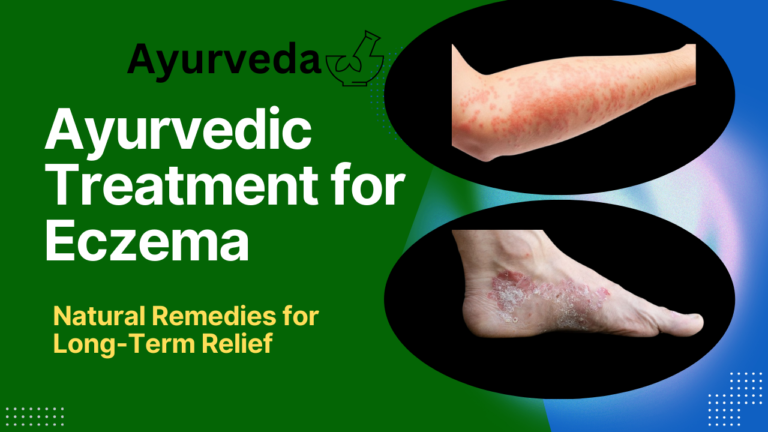 Ayurvedic Treatment for Eczema: Natural Remedies for Long-Term Relief